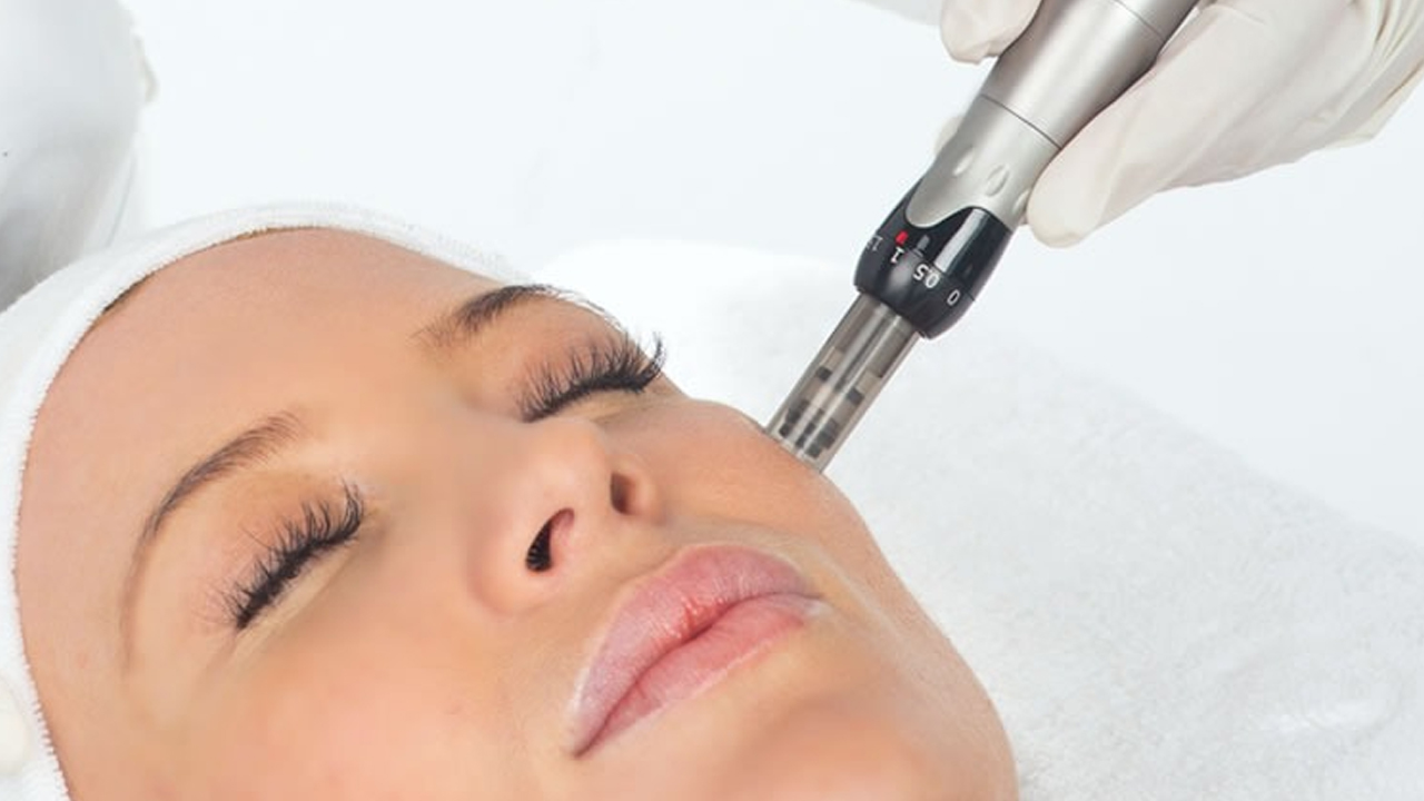 Microagulhamento Facial